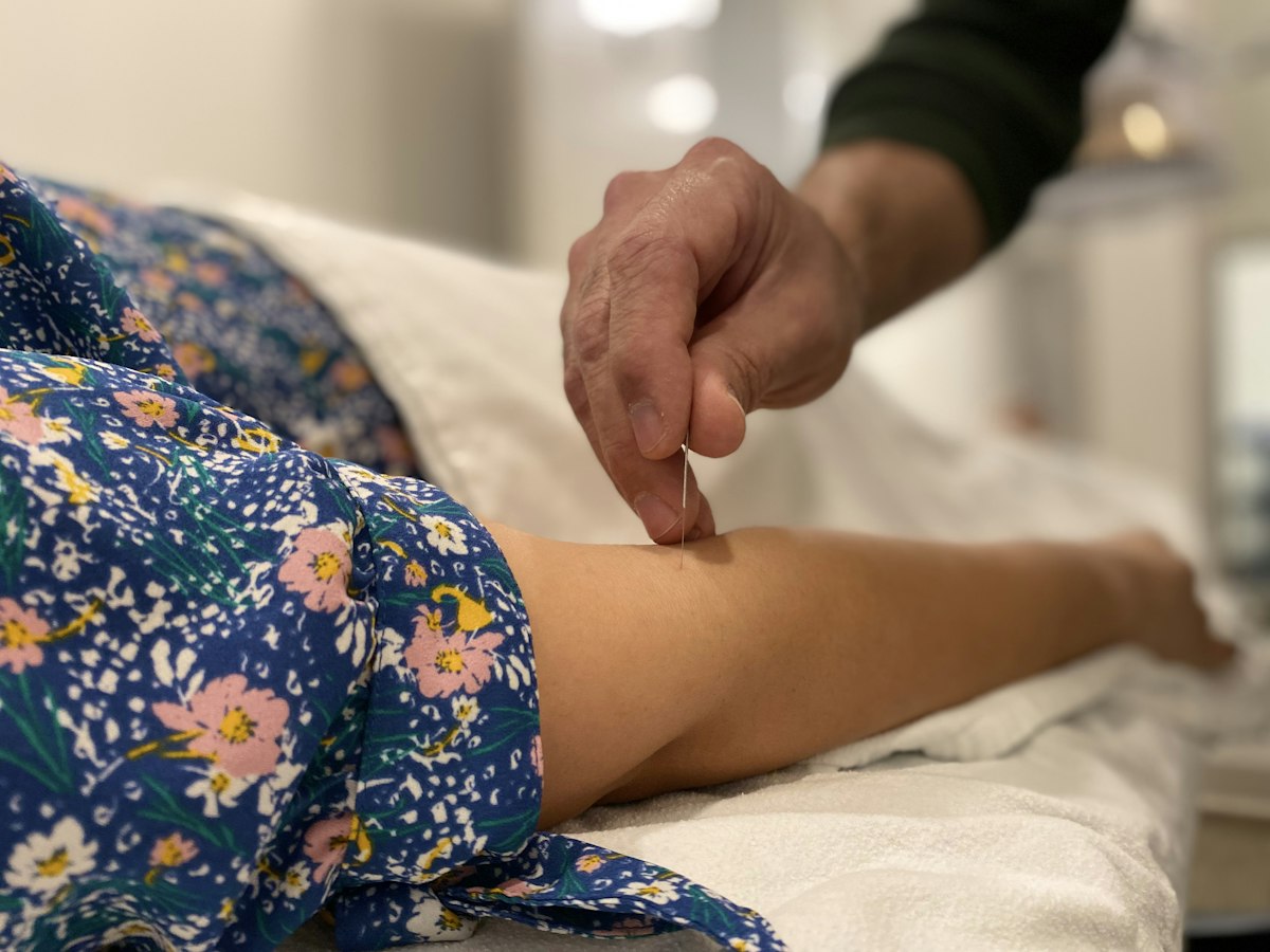 A practitioner placing a fine acupuncture needle in a person's lower leg on a treatment couch